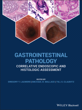 E-book, Gastrointestinal Pathology : Correlative Endoscopic and Histologic Assessment, Wiley