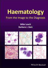 E-book, Haematology : From the Image to the Diagnosis, Wiley