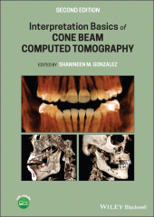 E-book, Interpretation Basics of Cone Beam Computed Tomography, Wiley