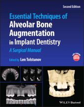 E-book, Essential Techniques of Alveolar Bone Augmentation in Implant Dentistry : A Surgical Manual, Blackwell