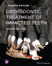 E-book, Orthodontic Treatment of Impacted Teeth, Blackwell