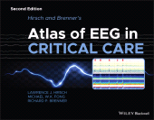 eBook, Hirsch and Brenner's Atlas of EEG in Critical Care, Blackwell