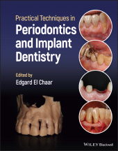 E-book, Practical Techniques in Periodontics and Implant Dentistry, Blackwell