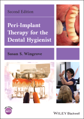 E-book, Peri-Implant Therapy for the Dental Hygienist, Blackwell