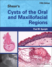 eBook, Shear's Cysts of the Oral and Maxillofacial Regions, Blackwell