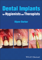 eBook, Dental Implants for Hygienists and Therapists, Blackwell