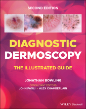 E-book, Diagnostic Dermoscopy : The Illustrated Guide, Blackwell