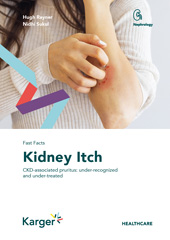 eBook, Fast Facts : Kidney Itch : CKD-associated pruritus: under-recognized and under-treated, Rayner, H., Karger Publishers