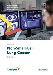 eBook, Fast Facts : Non-Small-Cell Lung Cancer, O'Brien, M., Karger Publishers
