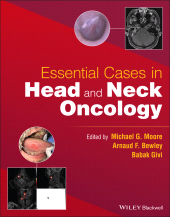 eBook, Essential Cases in Head and Neck Oncology, Wiley