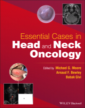 E-book, Essential Cases in Head and Neck Oncology, John Wiley & Sons