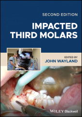 E-book, Impacted Third Molars, Blackwell