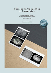 eBook, Hernias Infrecuentes y Complejas, Dykinson