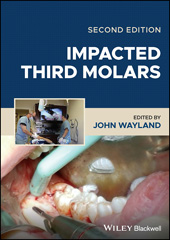 E-book, Impacted Third Molars, Wiley