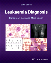 E-book, Leukaemia Diagnosis, Blackwell