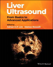 E-book, Liver Ultrasound : From Basics to Advanced Applications, Blackwell
