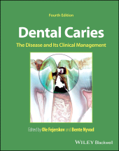 E-book, Dental Caries : The Disease and its Clinical Management, Blackwell