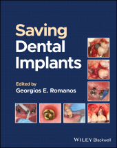 eBook, Saving Dental Implants, Blackwell