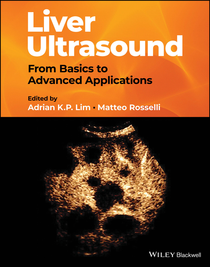 eBook, Liver Ultrasound : From Basics to Advanced Applications, Blackwell