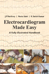 eBook, Electrocardiogram Made Easy: A Fully Illustrated Handbook, New India Publishing Agency
