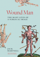E-book, Wound Man : The Many Lives of a Surgical Image, Princeton University Press