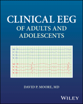 E-book, Clinical EEG of Adults and Adolescents, John Wiley & Sons
