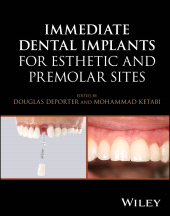 eBook, Immediate Dental Implants for Esthetic and Premolar Sites, John Wiley & Sons