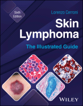 eBook, Skin Lymphoma : The Illustrated Guide, John Wiley & Sons