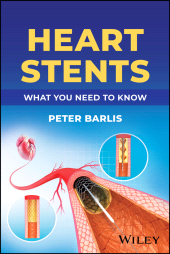 E-book, Heart Stents : What You Need to Know, John Wiley & Sons